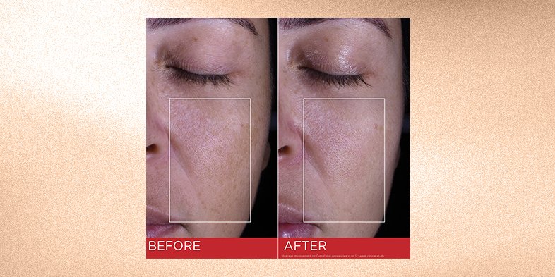 In-Article-collagen-skin-benefits_1
